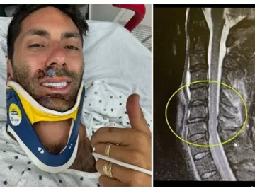 Apresentador de TV quebra o pescoço após ser atropelado por caminhão