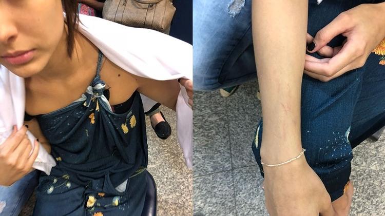 Em boletim de ocorrência, Leticia Almeida diz que foi agredida pela ex-sogra e tirou fotos na delegacia - Arquivo Pessoal - Arquivo Pessoal