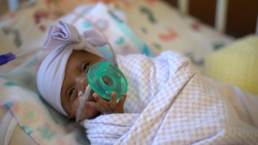 Saybie, que nasceu com 245 gramas, recebeu alta do hospital após cinco meses de cuidados intensivos - AFP