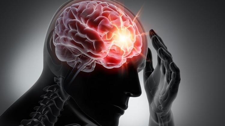 cérebro, derrame, AVC - Getty Images - Getty Images