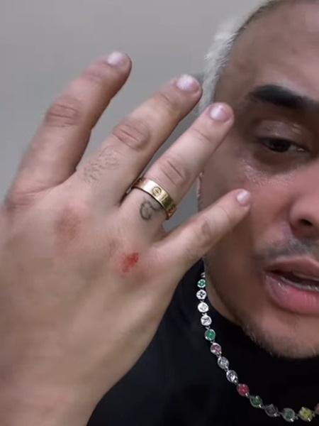 Kauan machuca a mão após queda em show no São João de Caruaru Kauan machuca a mão após queda em show no São João de Caruaru