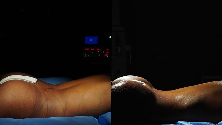 Lorena Maria: antes e depois Lorena Maria: antes e depois