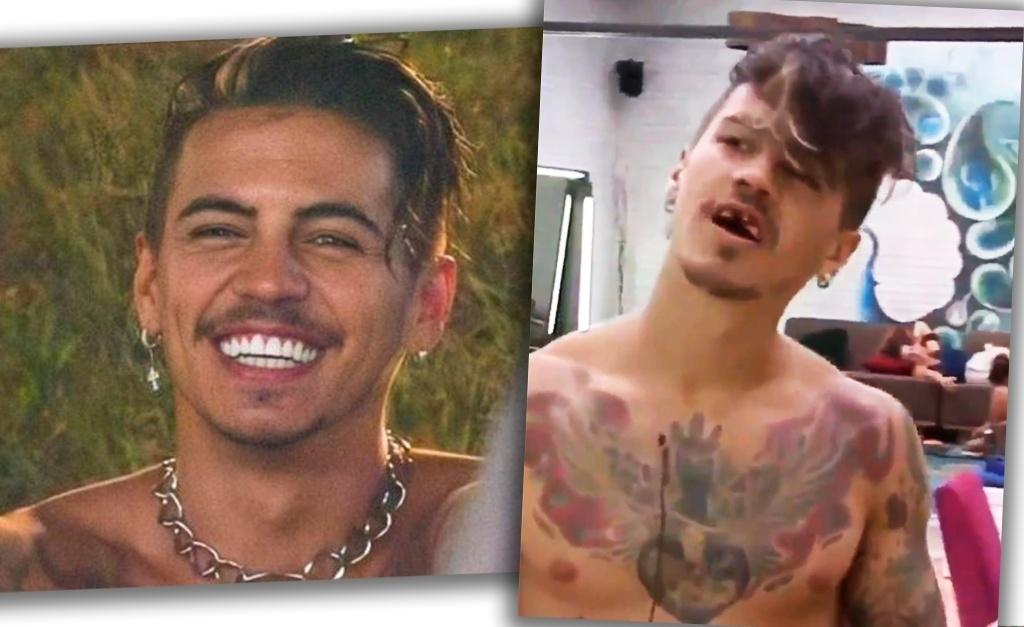 Biel com e sem as lentes de contato dentais - Reprodução/Twitter