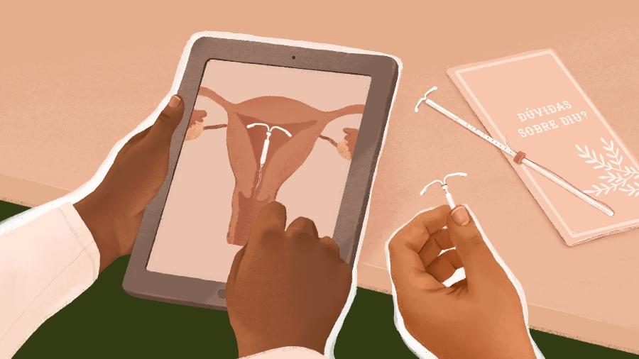 Contraceptivo de longa duração, DIU tem altas taxas de eficácia - Priscila Barbosa