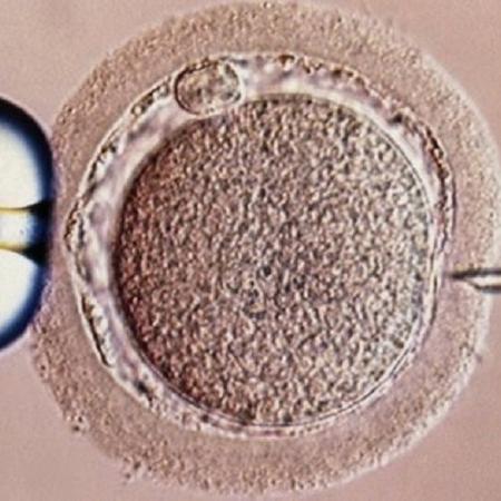 Fertilização in vitro deu errado nos EUA - SPL