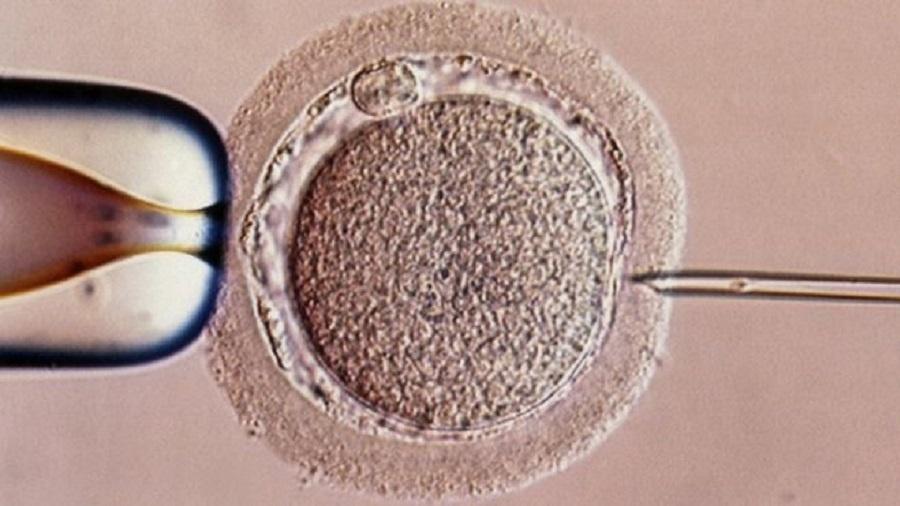 O bebê foi gerado usando uma forma experimental de fertilização in vitro - SPL