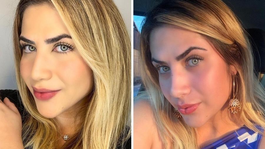 Antes e depois de procedimento no nariz de Jéssica Beatriz Costa - Reprodução/Instagram
