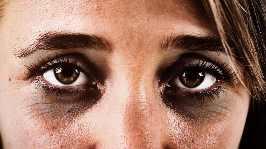 Olhos amarelados: 10 principais causas, sintomas e o que fazer