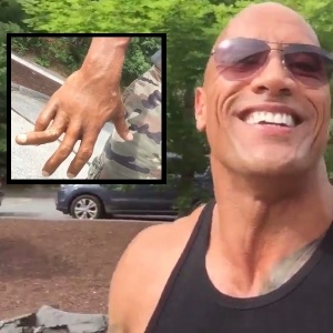 Dwayne Johnson mostra dedo ferido durante filmagem em post no Instagram - Montagem