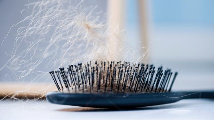 calvície, feminina, queda de cabelo - iStock - iStock