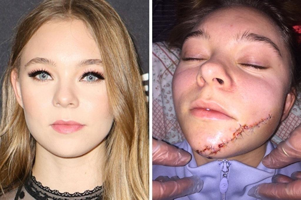 Atriz Taylor Hickson sofreu um corte no rosto durante gravações de "Ghostland" (2018) - Reprodução