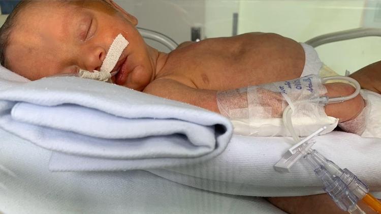 Karen Nunes Machado - pré-eclâmpsia 2 - Arquivo pessoal - Arquivo pessoal