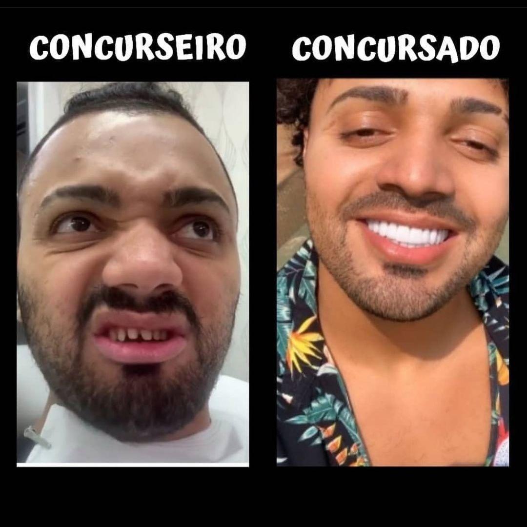 Tirulipa faz brincadeira com antes e depois de procedimento dental - Reprodução/Instagram