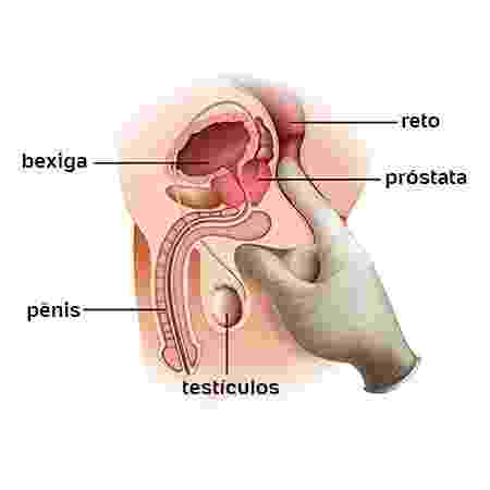Resultado de imagem para Imagem de cancer de prostata toque