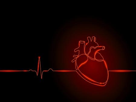 O que é Sopro no coração? – Hiper Clínica – Popular de Verdade – São Luís-MA