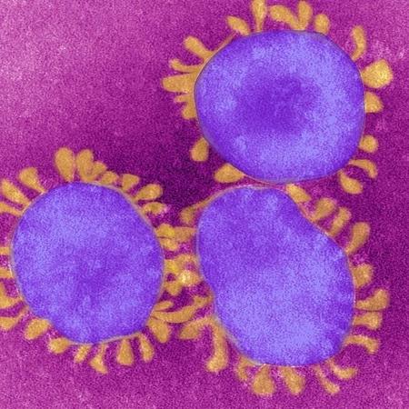 Visão do novo coronavírus em um microscópio - Getty Images via BBC