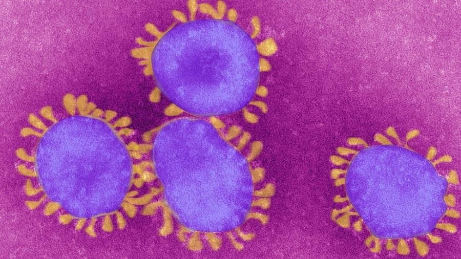 É assim que o coronavírus é visto no microscópio - Getty Images via BBC
