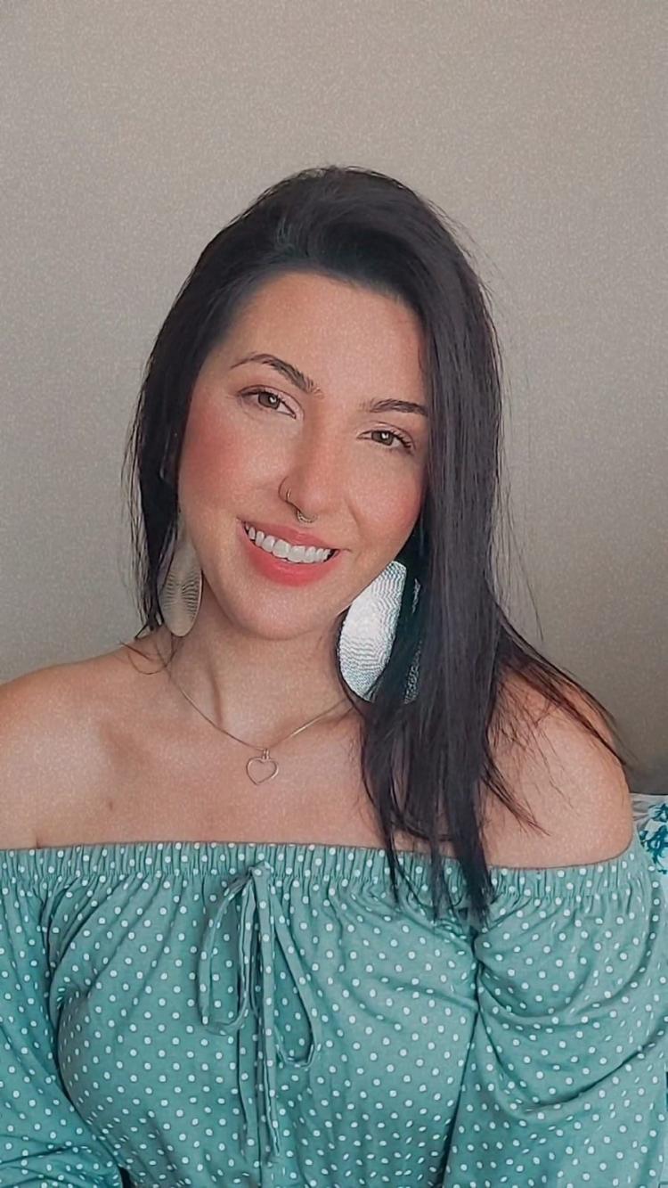 Luana hoje em dia, mais de um ano após as amputações Luana hoje em dia, mais de um ano após as amputações