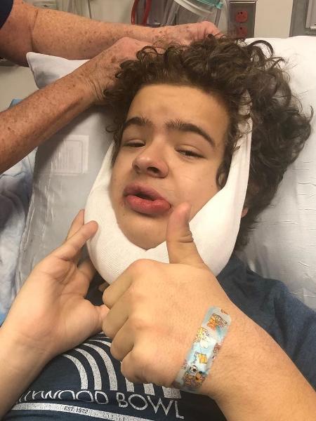 Gaten Matarazzo passa por nova cirurgia para corrigir a displasia cleidocraniana - REPRODUÇÃO/INSTAGRAM