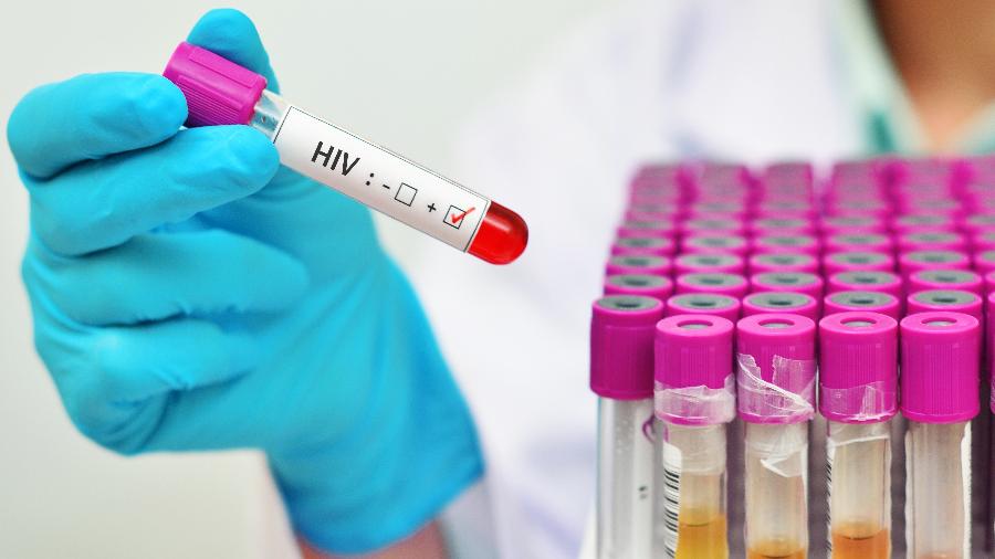 Governo vem recebendo críticas em relação à sua gestão na prevenção do HIV e de outras doenças sexualmente transmissíveis - iStock
