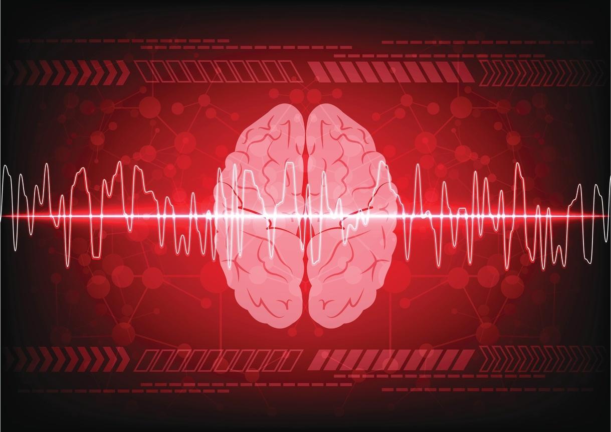 Na braço acidente no dor perna cerebral e direito vascular