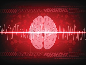 derrame cerebral causas sintomas e tratamentos