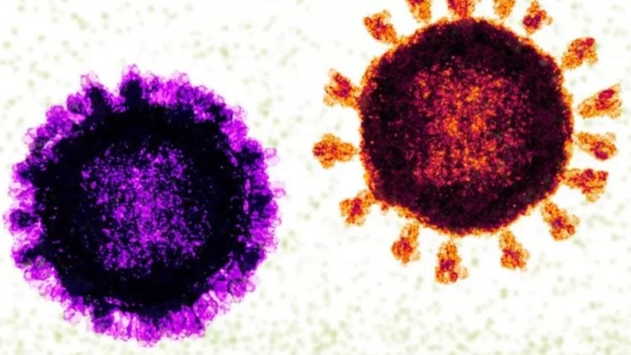 Os casos de flurona, em que há a detecção de influenza e coronavírus ao mesmo tempo, viraram notícia a partir da virada de 2022 - Getty Images/BBC