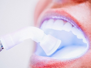 clareamento dental - Getty Images - Getty Images
