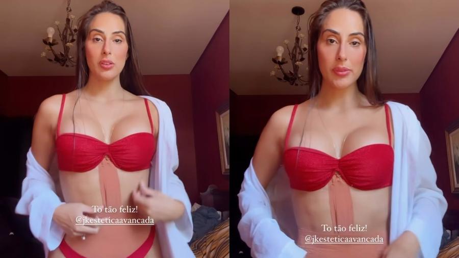 Ex-BBB Deniziane mostra resultado de cirurgias - Reprodução/Instagram
