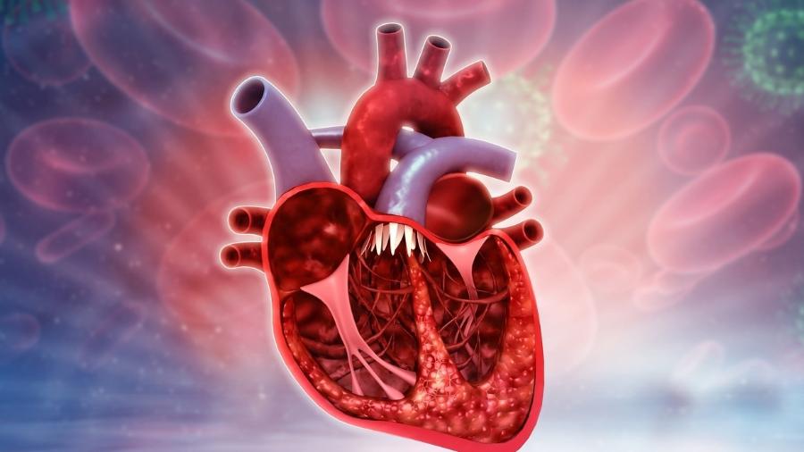 Insuficiência cardíaca: o que é, sintomas, como tratar e cuidados
