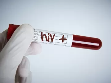 HIV em transplantados: laboratório receberia R$ 11 milhões do governo do RJ