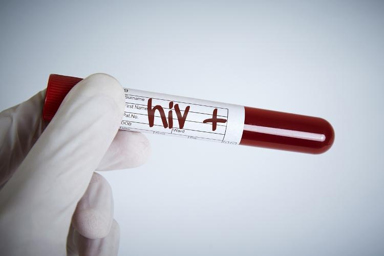 Teste positivo de HIV
