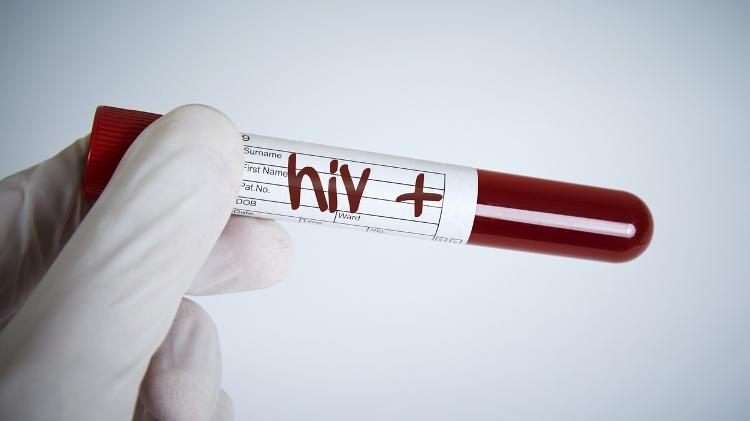 Teste positivo de HIV, Aids, epidemia - iStock - iStock