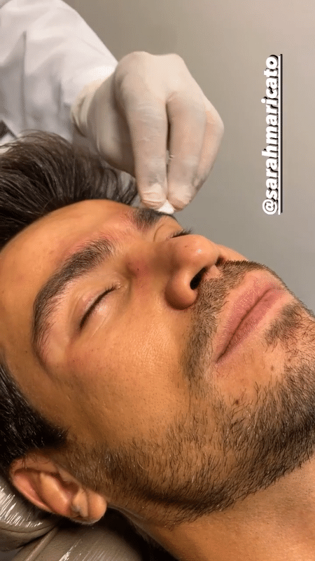 Mariano fez botox e mostrou no Instagram Stories - Reprodução/Instagram - Reprodução/Instagram