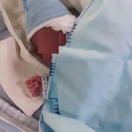 O bebê Noah Samuel teve a orelha cortada durante o parto - Arquivo pessoal