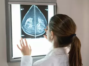 Câncer de mama afeta cada vez mais jovens; estudo aponta fatores de risco