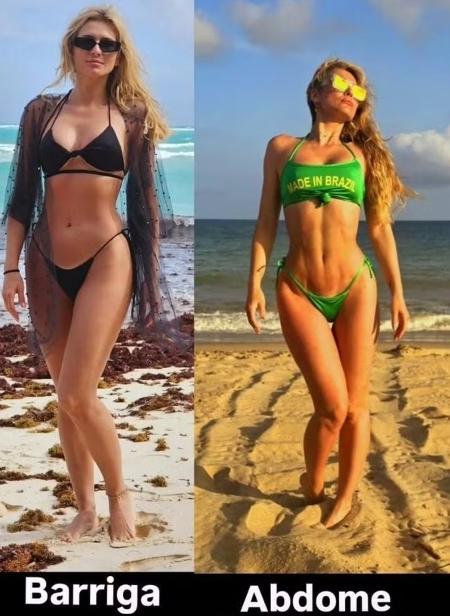 Lívia Andrade faz antes e depois de lipo LAD Lívia Andrade faz antes e depois de lipo LAD