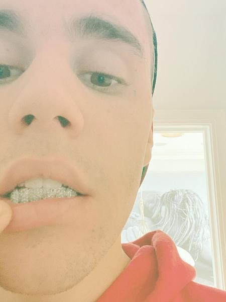 Justin Bieber ostenta dentes feitos com diamantes - Reprodução/Instagram