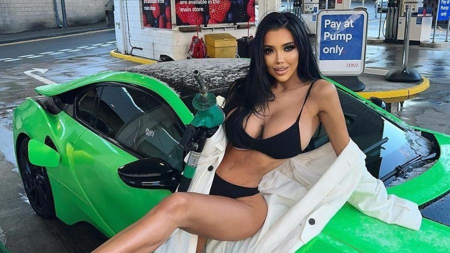 Musa do OnlyFans investe R$ 6,1 mi em plásticas em partes íntimas