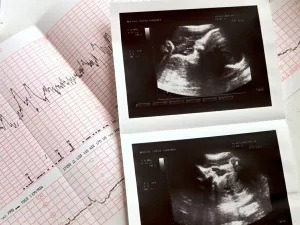 Por que nova lei que inclui ecocardiograma fetal no pré-natal é importante