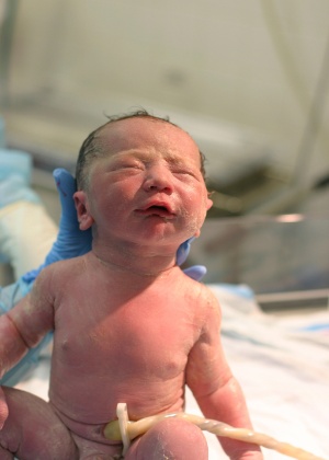 35% dos bebês têm circular de cordão  - Getty Images