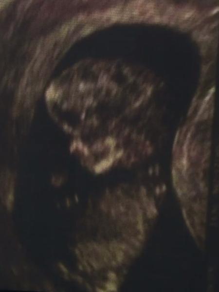 Juliana Alves mostra, no "Encontro com Fátima Bernardes", ultrassom de sua filha - Reprodução/TV Globo - Reprodução/TV Globo