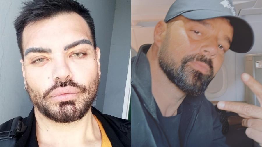 Fran Mariano diz que 30 cirurgias para parecer Ricky Martin não alcançaram objetivo - Reprodução/Instagram
