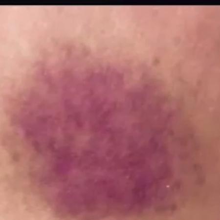 No programa "TV Fama", da RedeTV!, Renata Banhara mostra ferimento após relatar agressão do ex-marido - Reprodução/RedeTV! - Reprodução/RedeTV!