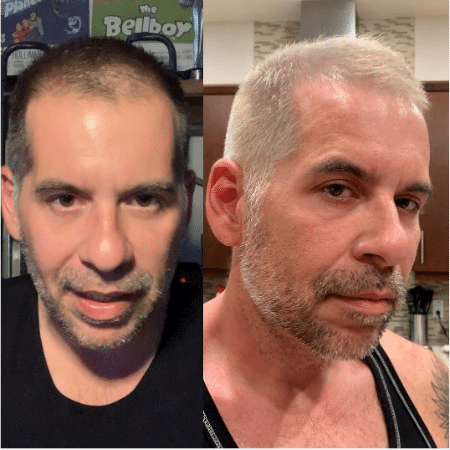 Leandro Hassum antes e depois de pintar os cabelos - Reprodução/Instagram