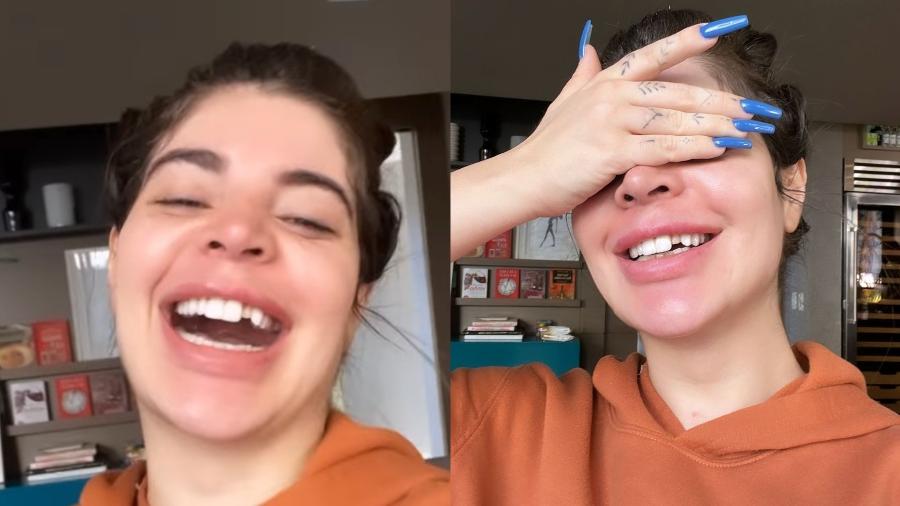 Gkay perde lente dental durante a noite: "Tenho bruxismo fortíssimo" - Reprodução/Instagram