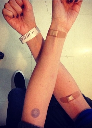  Dani Calabresa publica foto de curativos após exames em hospital