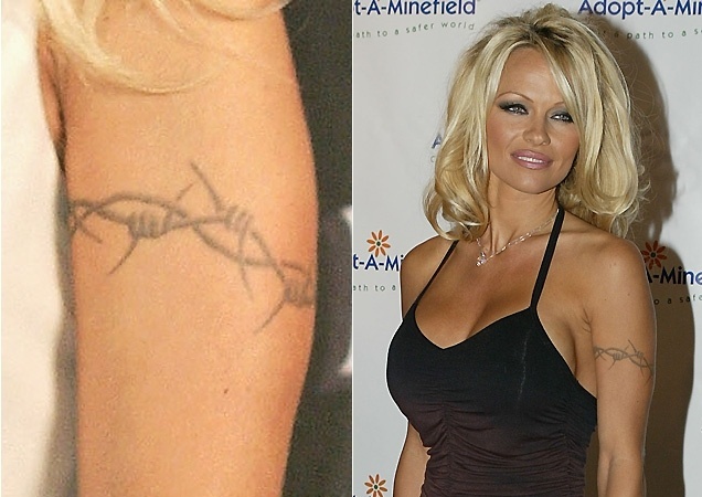 A atriz Pamela Anderson dividiu a agulha com seu marido na época, o baterista Tommy Lee, quando fez essa tatuagem de arame farpado no braço, e disse que pegou hepatite do ex