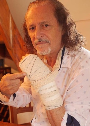 Alceu Valença posta foto em seu perfil do Facebook mostrando o braço enfaixado - Reprodução/Facebook