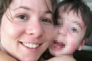Clara Colker (filha de Deborah Colker) e o filho Theo, que possui epidermólise bolhosa, que causa manchas na pele - Reprodução/Facebook